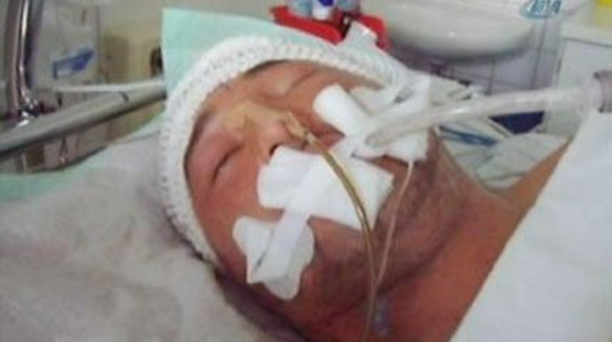 Alman polisin d&ouml;vd&uuml;ğ&uuml; gen&ccedil;, hayatını kaybetti