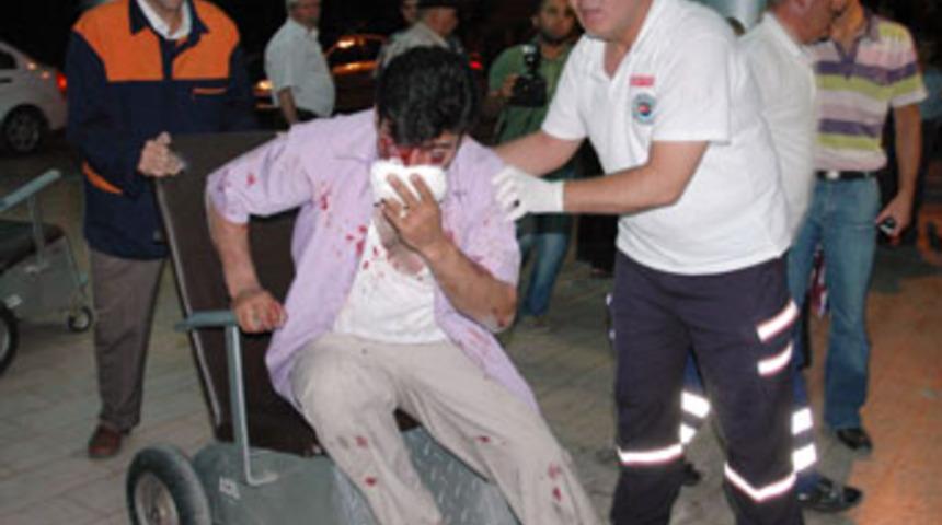 'Burnunu sokma' dedikleri kişinin burnunu kestiler