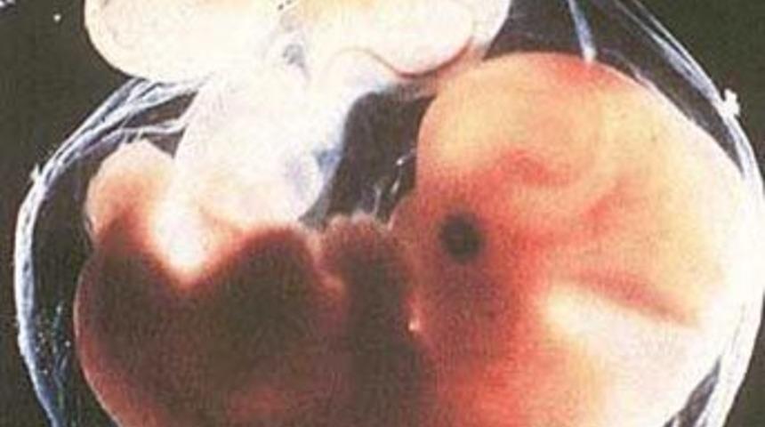 Duyma engelli &ccedil;iftlerden &uuml;rperten &ouml;neri