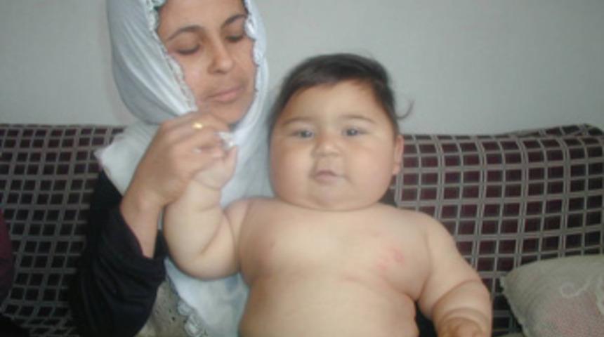 11 aylık Rumeysa 20 kiloya ulaştı