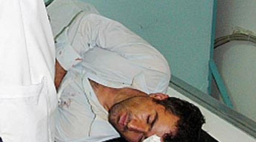 Karısının taşlı saldırısına uğrayarak hastanelik oldu