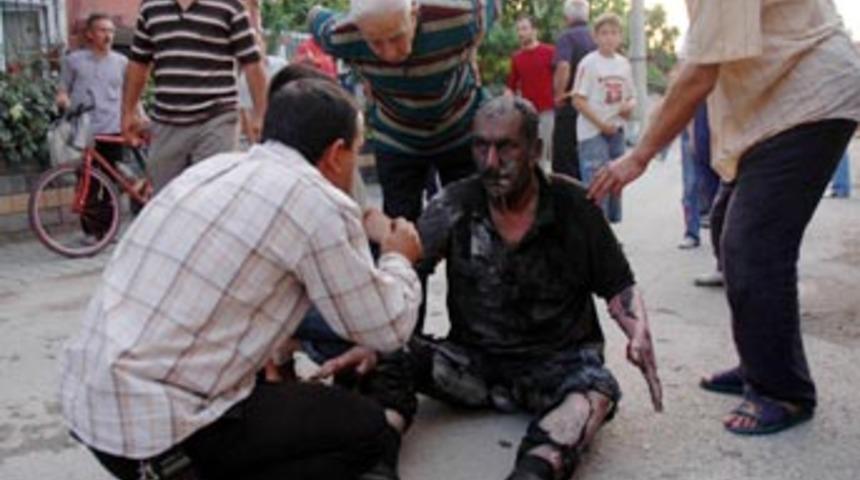 Adapazarı'nda vernik kutuları patladı: 3 yaralı