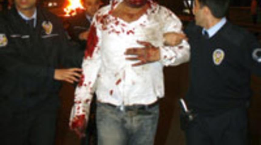 G&uuml;rb&uuml;z &Ccedil;apan'ın oğlu kaza yaptı: 1 &ouml;l&uuml;