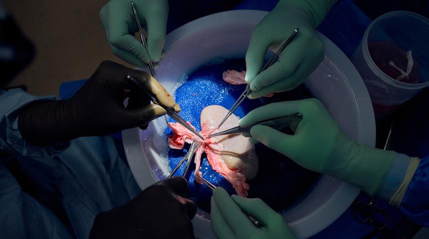 Tıp dünyası şokta: Organ naklinde devrim niteliğinde atılım! Yaptıkları o hamleyle domuz böbreği insan vücudunda çalıştırıldı... 