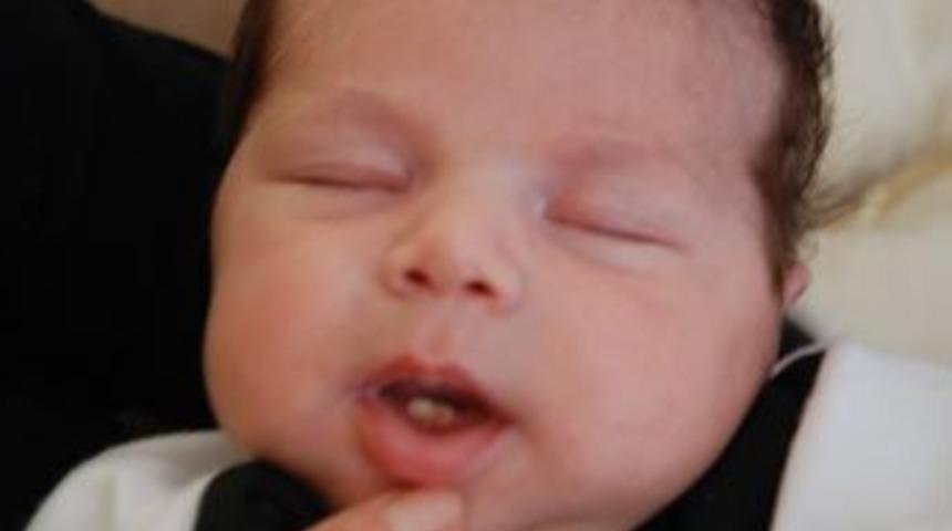 2 dişiyle birlikte doğdu