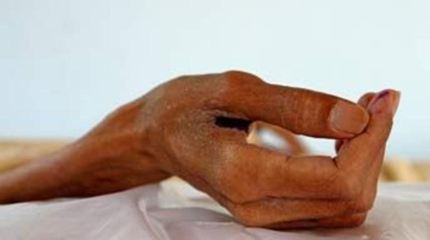 Almanya'da 2 bin 752 yeni AIDS vakası