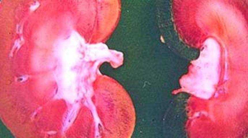 Oğlunun okul masrafı i&ccedil;in b&ouml;breğini satıyor