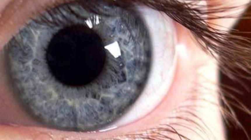 G&ouml;z testiyle otizme erken tanı