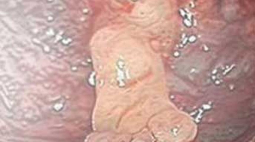 Beyninde ayakla doğdu