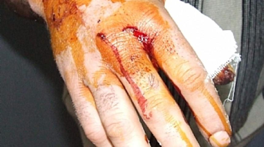 Kangal k&ouml;peği dehşet sa&ccedil;tı