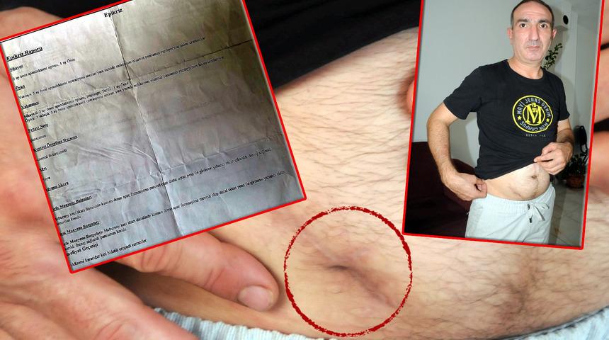 Aylarca dayanılmaz ağrılar çekti! Skandal gerçek ameliyat öncesi ortaya çıktı: "Bak bakalım karnından ne çıktı" 12 santimlik...