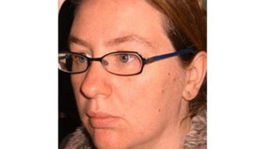 Estetik masrafı i&ccedil;in ikizlerini sattı