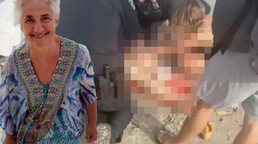 Denizde yüzerken bir anda kabusu yaşadı! Su adeta kan gölüne döndü... “Kalıcı sakatlığa neden oldu”