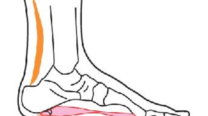 Topuk Dikenine tedavi