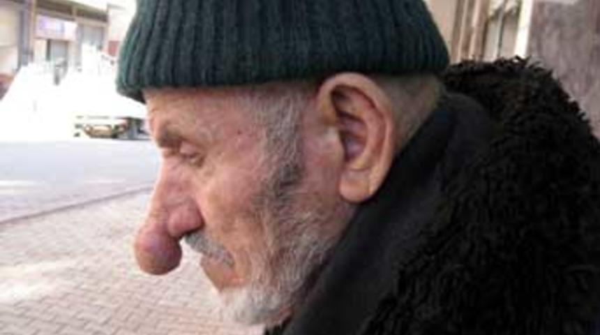 Burnuyla g&ouml;renleri şaşırtıyor