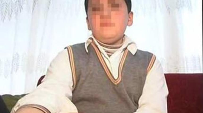 &Ouml;ğrencinin koluna 'temizlik' notu