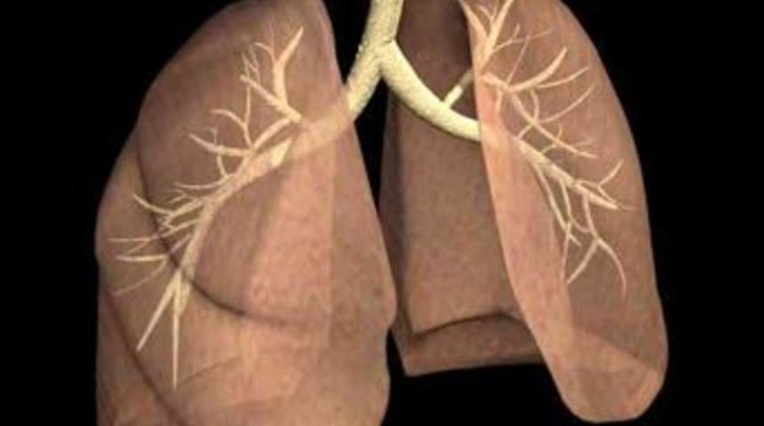 KOAH t&uuml;m d&uuml;nyada 4. &ouml;l&uuml;m nedeni