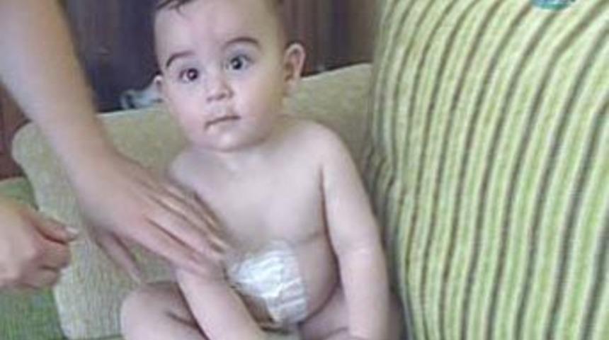 Skandal...Yanmış bebeği hastaneye almadılar