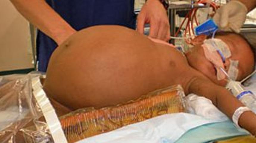 Ağırlığının &uuml;&ccedil;te biri t&uuml;m&ouml;rd&uuml;