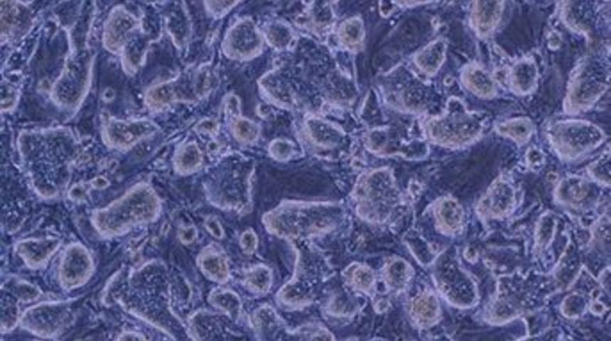 Polyanna geni bulundu