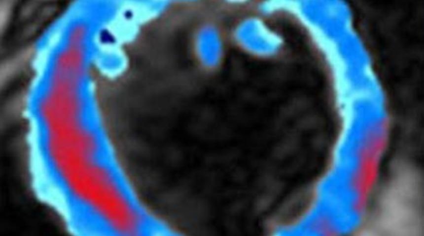 Kalp krizinin fotoğrafı çekildi!