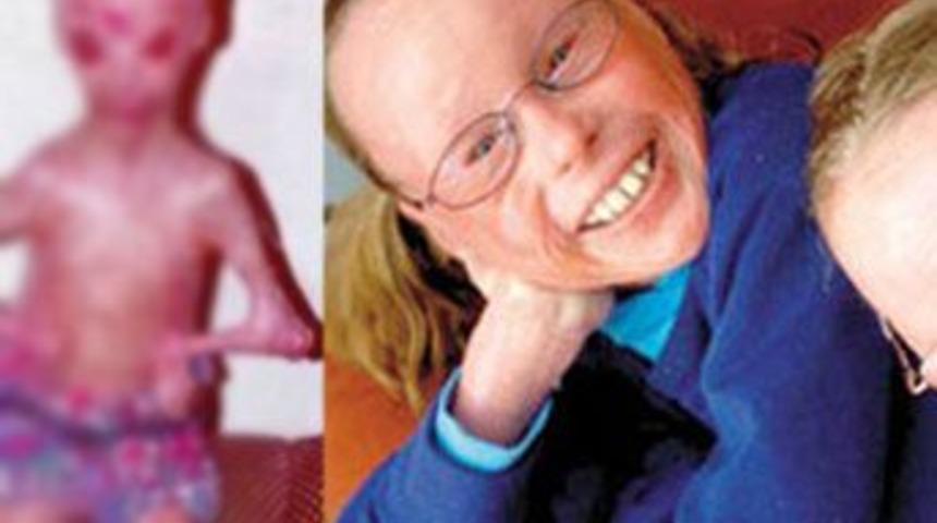 D&uuml;nyanın en garip 5 hastalığı