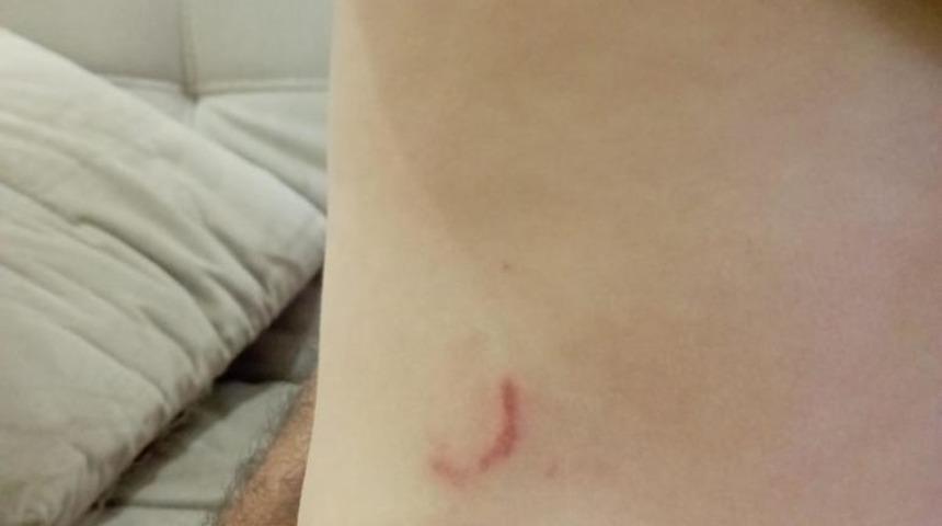 Karabük'te sokak köpeklerinin saldırısına uğrayan çocuk yaralandı