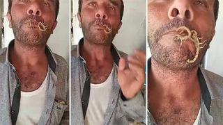 Tüyler ürperten görüntüler! Akrepleri ağzına alıp kendini sokturdu, sözleri şaşkına çevirdi: 'Amerika nasıl kolanın sırrını vermiyorsa...'