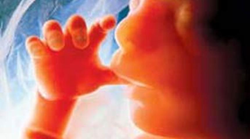 İkiz kardeşini 9 yıl karnında taşıdı