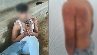 Her satırı korkunç: Babası ve amcasından 15 yaşındaki çocuğa ahırda işkence! Dayısını öldürmesini istediler... 