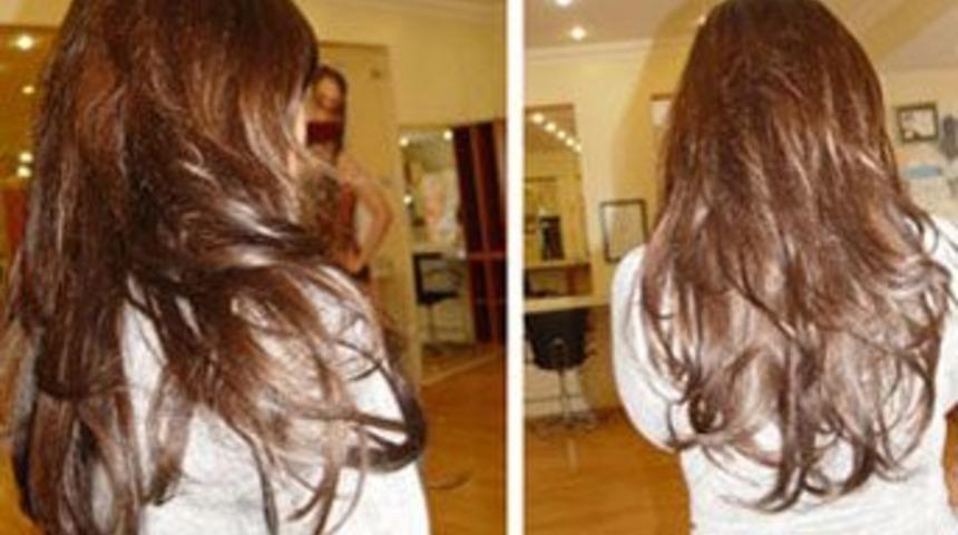 Sa&ccedil; uzatmada halka kaynak