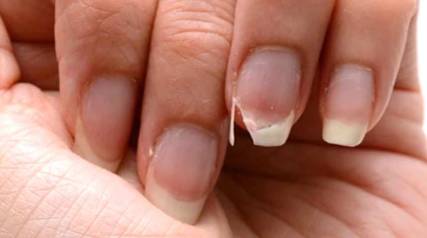 Tırnak kırılması sorununa en etkili çözümler! Tırnaklarınız eskisinden daha güçlü olacak