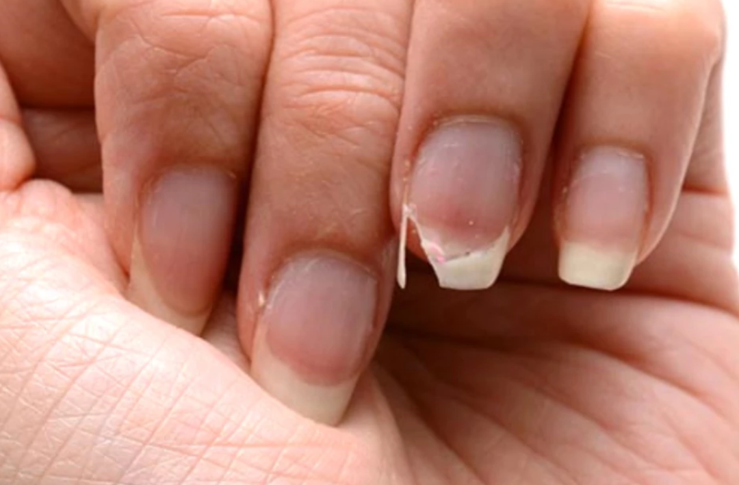 Bu belirtilere dikkat! Dış g&ouml;r&uuml;n&uuml;ş&uuml;n&uuml;zden tahmin edebileceğiniz vitamin eksiklikleri