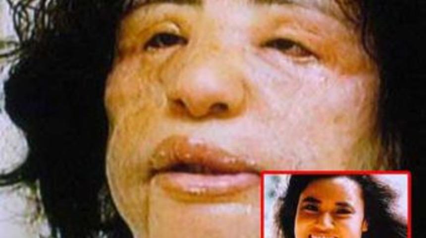 Estetik takıntısı bu hale getirdi