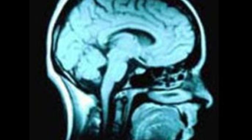 Eksi 100 derecede tedavi