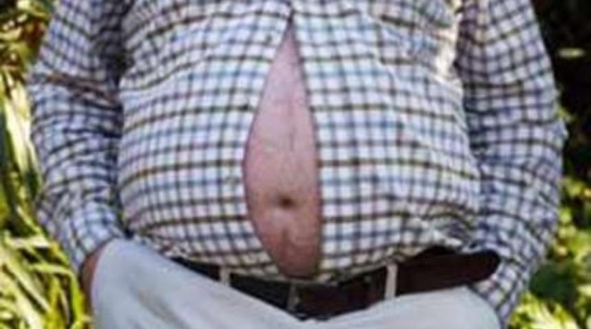 G&ouml;beklenme ile akciğer fonksiyonu arasında bağlantı