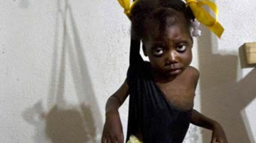 Gıda krizi &ccedil;ocukları vuruyor