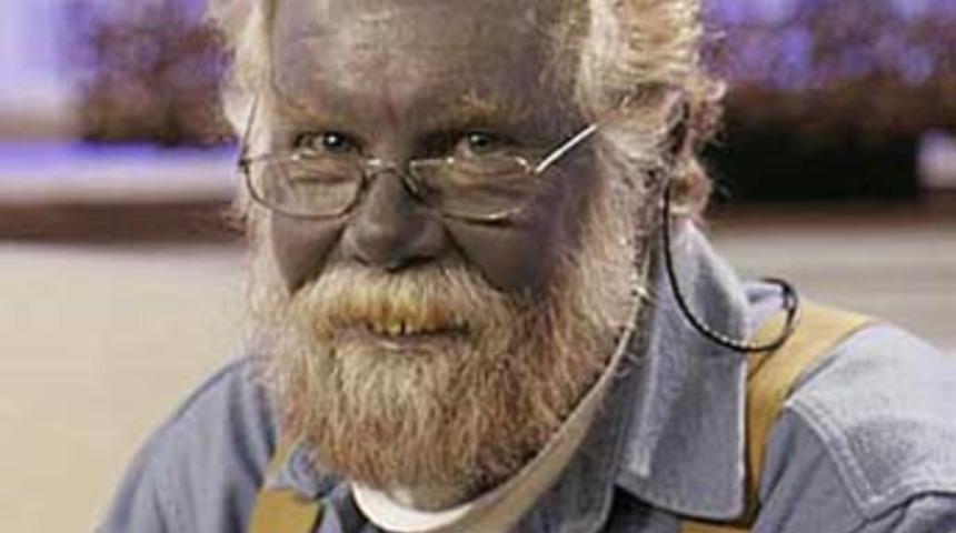 Sivilce patlatayım derken 'Şirin Baba' oldu