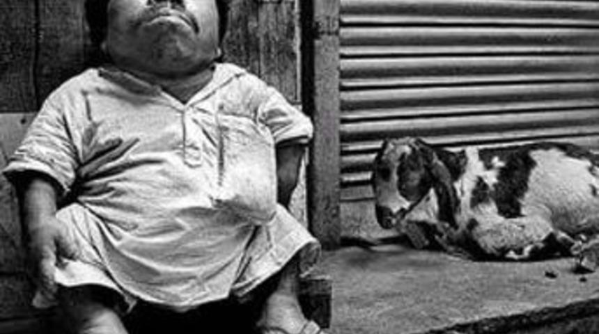 Kısa boyun tek nedeni genler değil