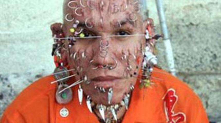 Y&uuml;z&uuml;nde 300 delik var