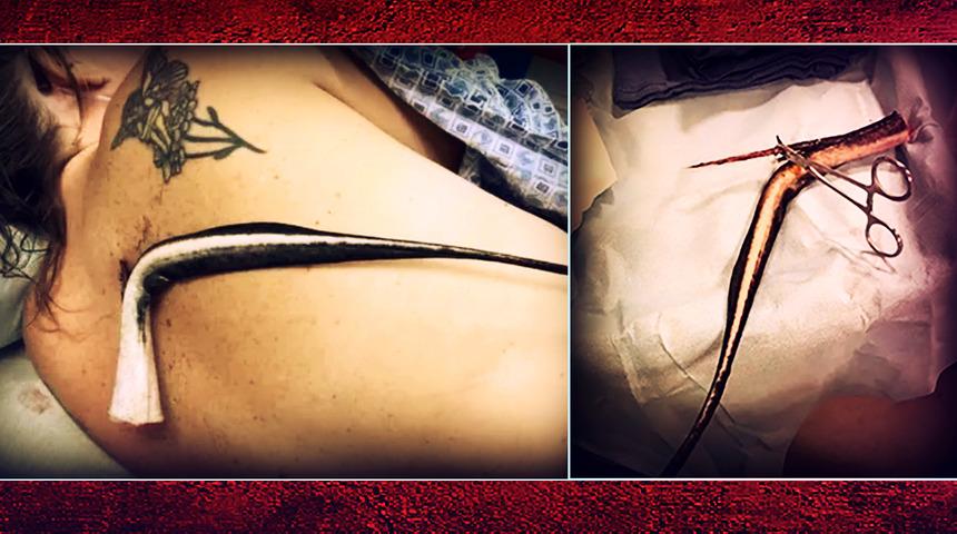 Kocası onu bulduğunda hayvan santimetrelerce derinliklerindeydi! Sırtına vatozun iğnesi saplanan kadın günlerce beklemek zorunda kaldı