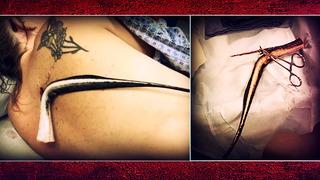 Kocası onu bulduğunda hayvan santimetrelerce derinliklerindeydi! Sırtına vatozun iğnesi saplanan kadın günlerce beklemek zorunda kaldı