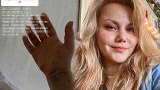 Eşi tarafından 32 yerinden bıçaklanmıştı! Fenomen Merve Veziroğlu'ndan üzen açıklama