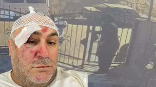 Dambıl barı ile gasbedilmişti! Kameralar incelendi, saldırgan çalışanı çıktı