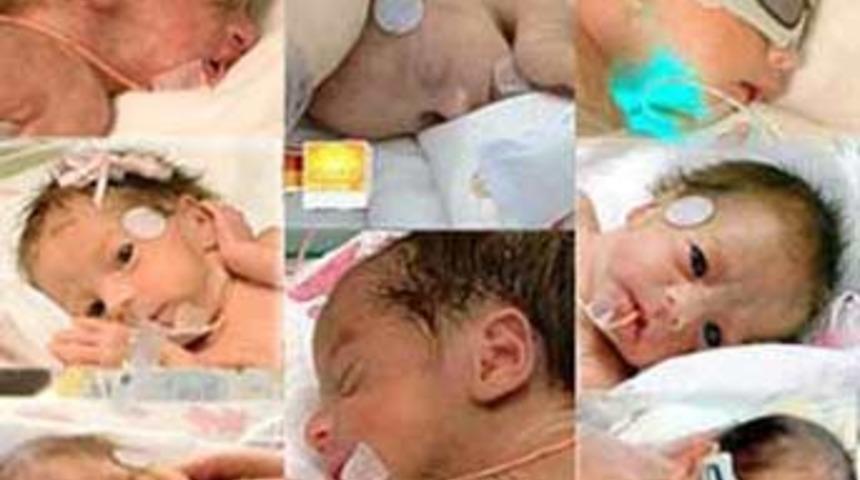 İşte d&uuml;nyanın merakla beklediği mucize sekizizler