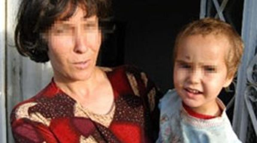 Kızının y&uuml;z&uuml;n&uuml; sigarayla yakan baba serbest