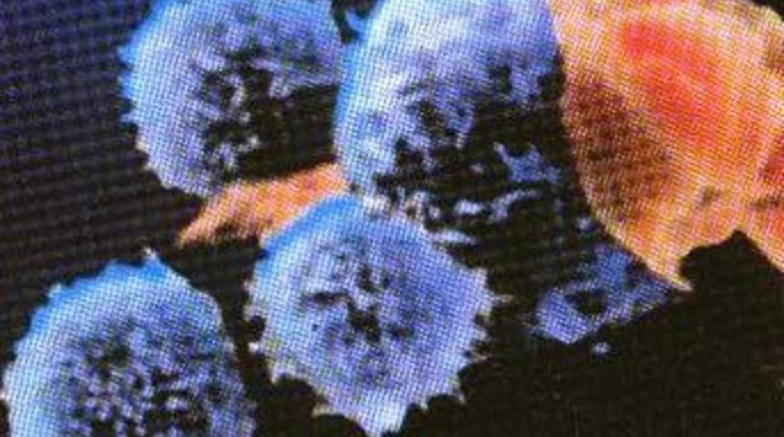 T&uuml;rkiye'de AIDS'li insan sayısı 2 bin 544