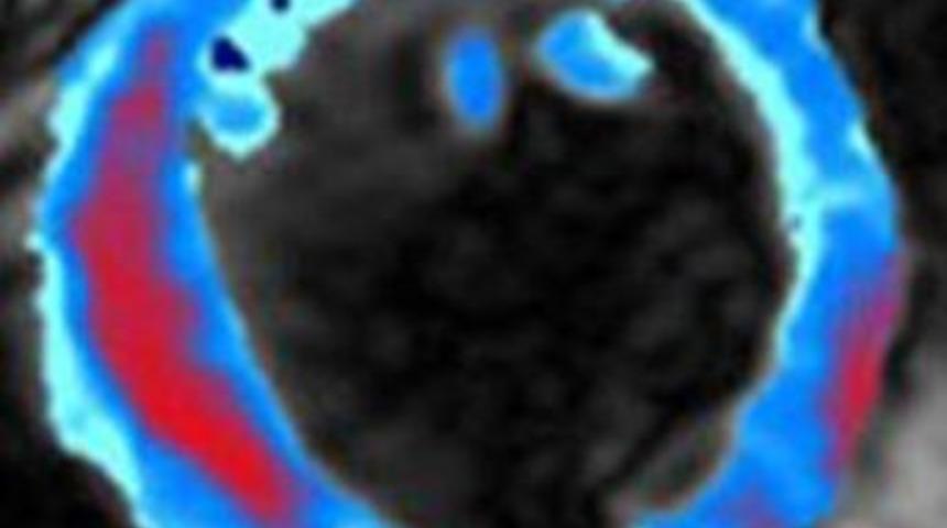 Kalp damar cerrahının başarı form&uuml;l&uuml;