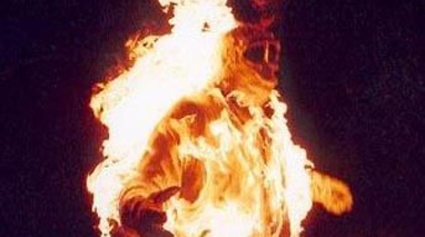 İşadamını otel odasında yaktılar