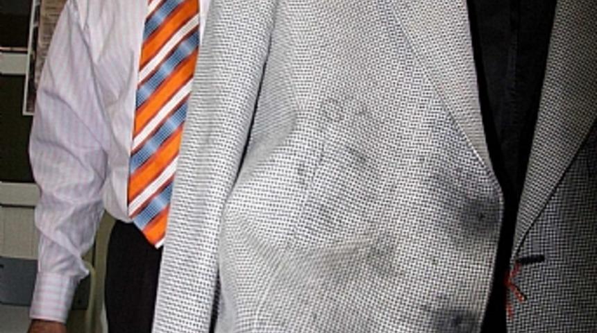 Eriyen ceket d&uuml;ğmeleri i&ccedil;in hukuk savaşı başlattı